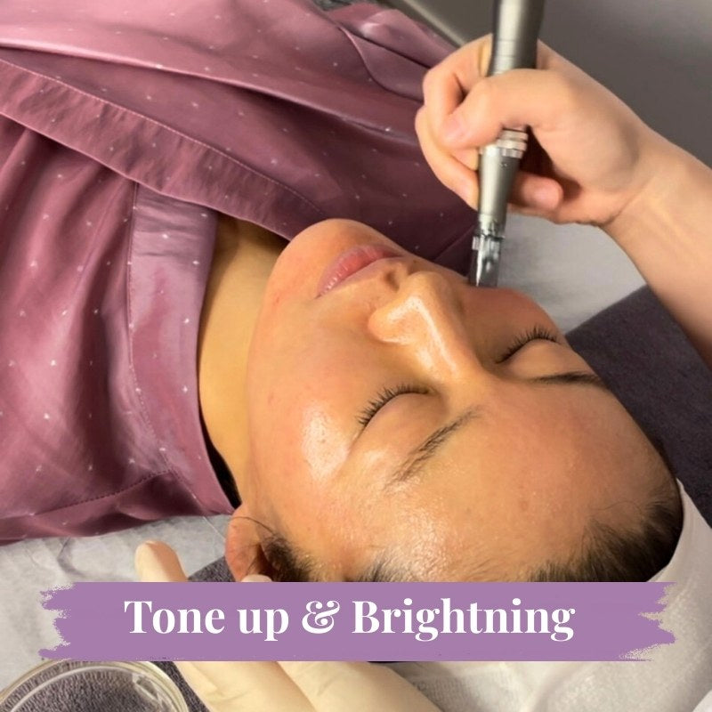 Micro-needling & Skin Boosters