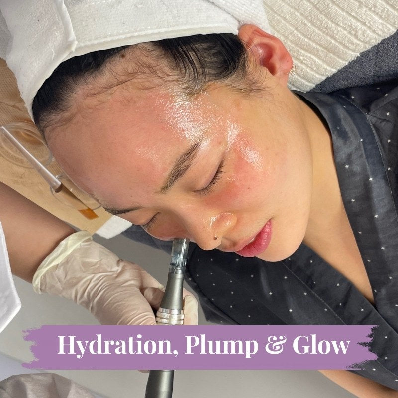 Micro-needling & Skin Boosters