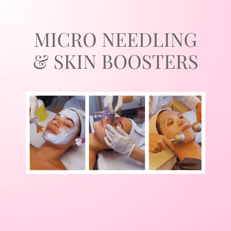Micro-needling & Skin Boosters